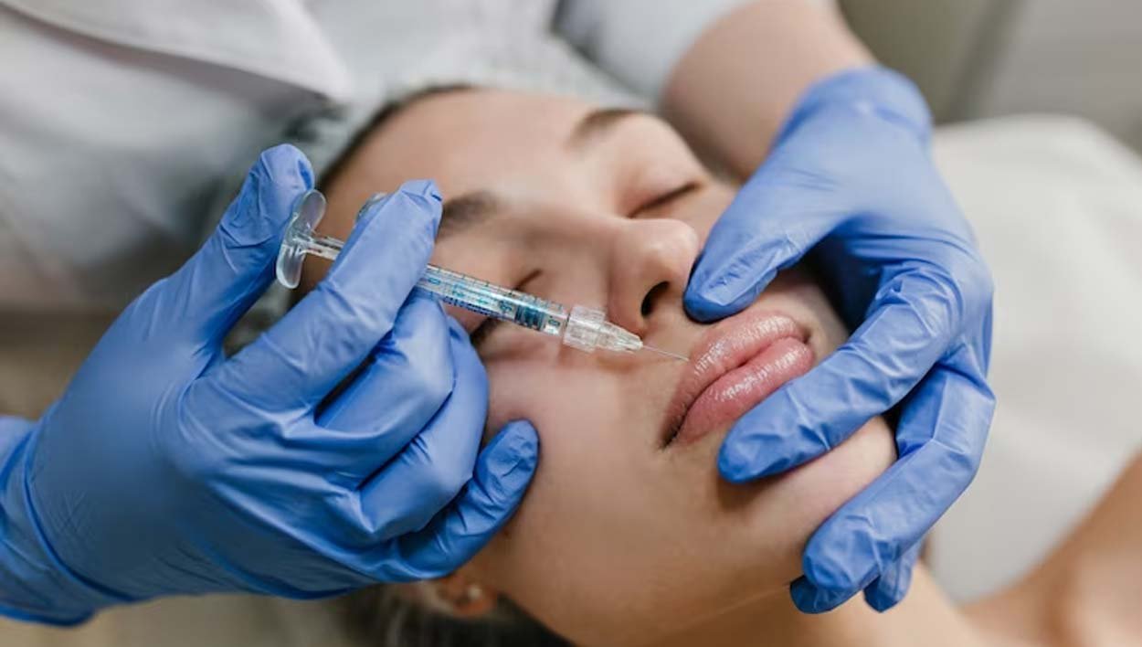LIP FILLERS